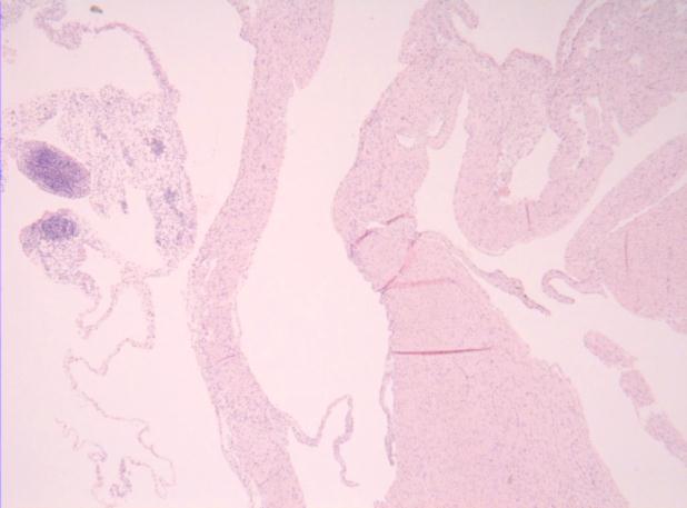 (myocarditis) 을패혈증마우스 2마리의심장에서관찰하였다 (Fig. 1B).