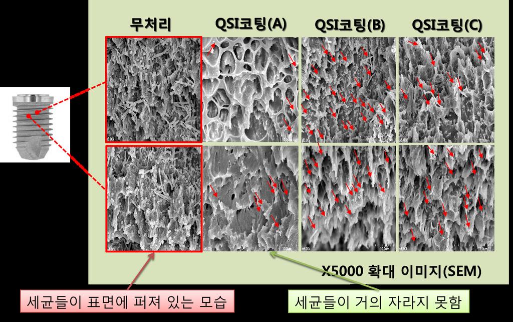 그림 5) 치과용 임플란트 표면에 쿼럼센싱 억제제를 코팅하고 세균배양을 한 후 전자현미경 확대 사진.