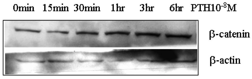 대한내분비학회지 : 제 22 권제 6 호 2007 Fig. 1. Effect of PTH on levels of β-catenin in mouse osteoblastic cells.