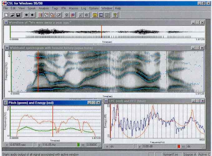 소음대배음비 (NHR) VRP (Voice Rage Profile) SPG(Soud spectrographic