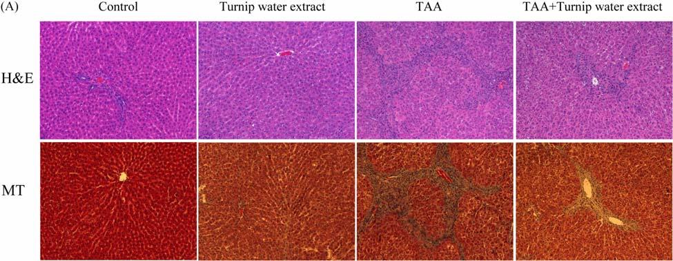 Turnip water extract inhibits TAA-induced hepatofibrogenesis in rat model 5 Figure 4.