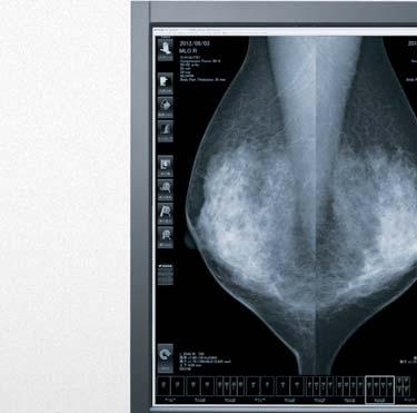 Digital Mammography Monitors