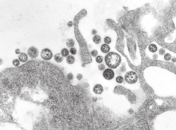 주간건강과질병 제 11 권제 33 호 Figure 2. A transmission electron micrograph (TEM) of a number of Lassa virus virions adjacent to some cell debris (Source: CDC, Public Health Image Library, https://phil.cdc.