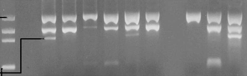254 김태윤등. 23S rrna 점돌연변이 H. pylori 2) 내성유전자변이검사 Dual priming oligonucleotide system기법을도입하여개발된 Seeplex ClaR-H. pylori PCR kit (Seegene Inc., Seoul, Korea) 의 Seeplex Home-brew primer mix를이용하여유전자를증폭하였다.