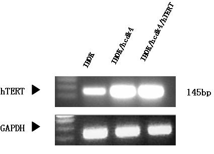 (A) There is a significant expression of p53 in HPV16 E6/E7 immortalized cell lines (IHOK, IHOK/hcdk4 and IHOK/hcdk4/hTERT). YD-10B of lane 4 is negative control of p53.