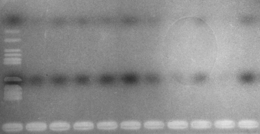 7%)을 나타냈고 선암종과 선양낭성 암종에서는 음성을 나타내었으며, 아형검사에서는 예중 3 Fig. 1. Amplification of a 40bp DNA fragment by PCR using HPV consensus primer. Twelve ul of each reaction mixture is run on 1.