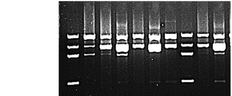 Cho AR, et al., Clarithromycin Resistance of H. pylori 383 A2142G 돌연변이로해석하였다 (Fig. 1).