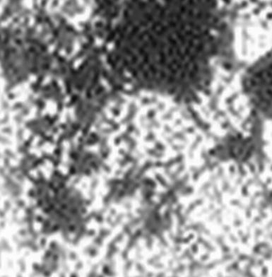 심재영외 3 인 :Genistein 이 MG-63 조골세포의증식과세포외기질형성에미치는영향 51 Fig. 3. Effects of genistein on mineralization in MG-63 cell. Cell was stained by Von Kossa Stating Solution. 특히골조직에서는골성장이활발히일어날때그활성이증가한다.