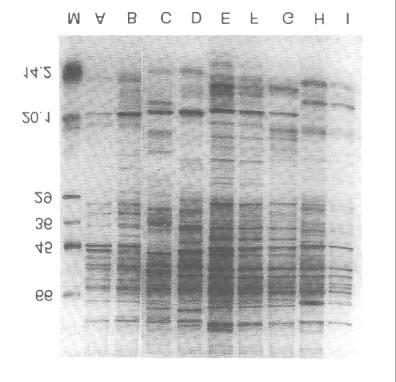 Fig.3. SDS-PAGE of cell proteins of bifidobacteria. S. Molecular marker; A. B. bifidum KCTC 3418; B. B. bifidum KCTC 3357; C. B. adolesecntis KCTC 3416; D. B. adolescentis KCTC 3216; E. B. breve KCTC 3461; F.