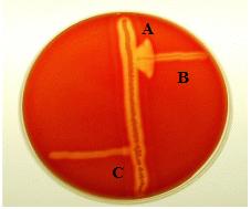 25 장. 식품매개감염 A : Staphylococcus aureus B :