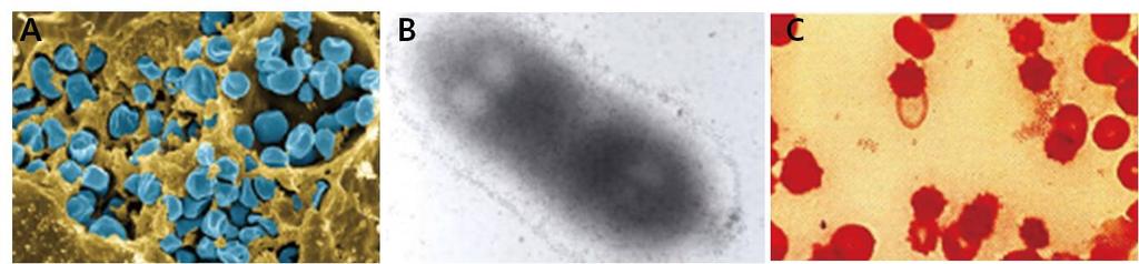 7. 야토병 (Tularemia) 야토병은탄저균, 흑사병과마찬가지로, 동물원성감염증 (zoonosis) 으로 Fransicella tularensis 에서기인하였다 ( 그림 13A). 이병원성미생물은그람음성균, 절대호기성, non-motile, 구간균이다.