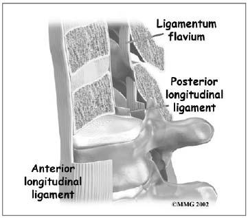 [ 그림 4] 척추의인대 척추의후방부에는상극인대 (supraspinous ligament) 와극간인대 (interspinous ligament) 등이극돌기를연결하고있으며황색인대 (ligamentum flavum) 가척수강후면에위치한다.