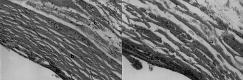 A B C D Fig. 5. Microscopic findings of ablated tissue of bile duct (H-E stain, 40). A.