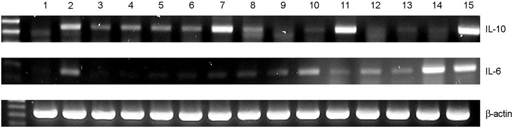 174 D Jin, et al. Figure 1. Expression of IL-10 mrna in RAW 264.7 cells treated with various Bifidus strains. Lane 1, control; Lane 2, LPS 100 ng/ml; Lane 3, B. infantis; Lane 4, B.