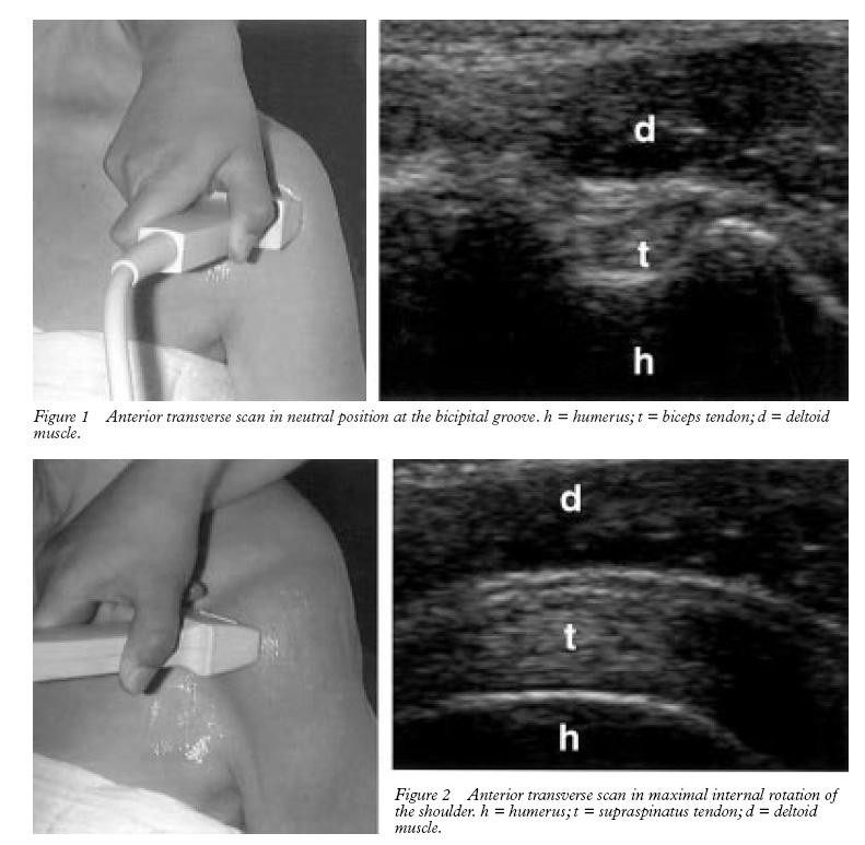 ultrasound in rheumatology 1.
