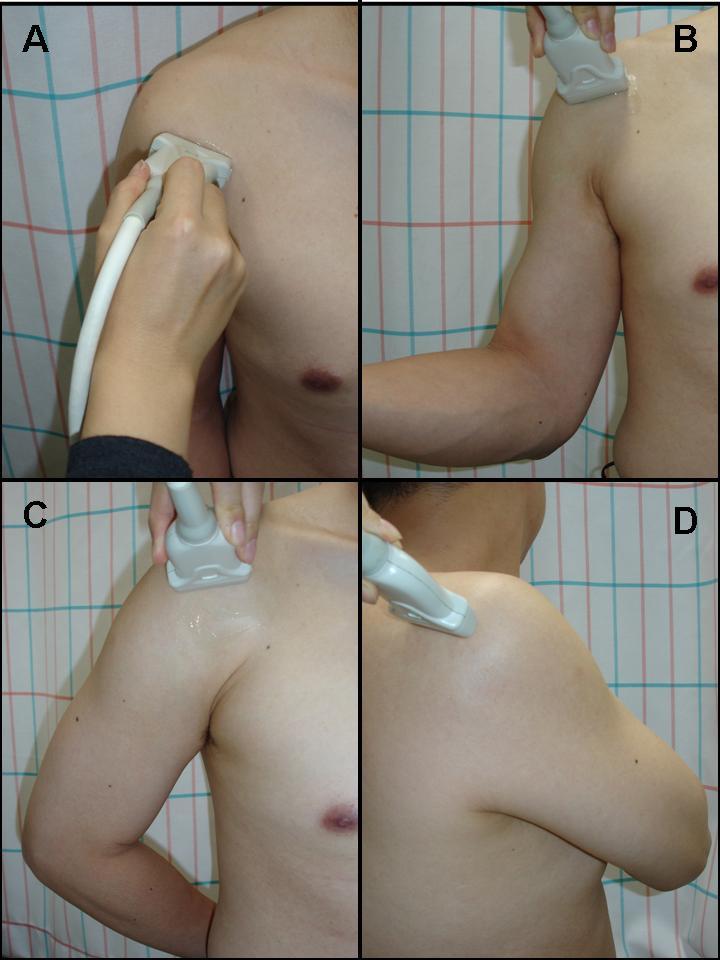 Fig. 1. 어깨관절의초음파스캔방법과환자의자세. (A) 위팔두갈래근가로스캔, (B) 어깨밑근가로스캔, (C) 가시위근가로스캔, (D) 위팔어깨관절가로스캔. 두갈래근의긴갈래를가로와세로스캔으로관찰한다.