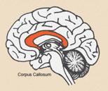 들보 ( 뇌량 ) 가분리된두반구를연결하고있다. 앞뇌에서유래된간뇌는시상, 시상하부, 뇌하수체후엽, 송과체등이있다. 시상은대뇌로가는감회색질각정보를적절히조절하는역할을담당한다.