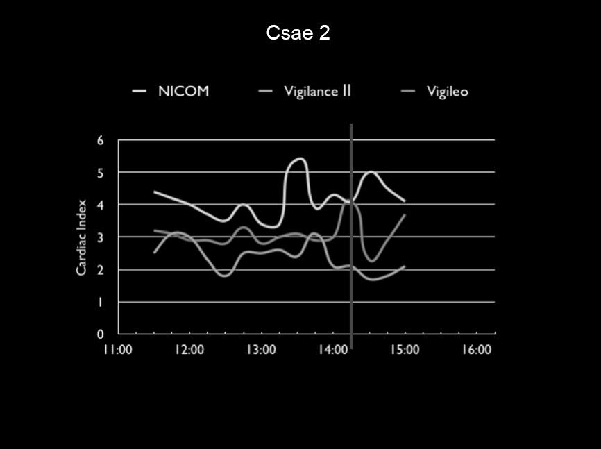 Bioreactance/Nicom system use their unique system called Bioreactance. Thoracic resistance elements and reactance elements can influence on Bioreactance as a variables.