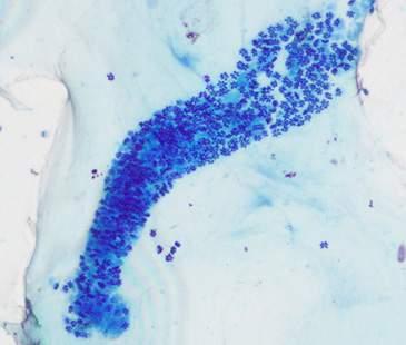 가 개요 1) 병원체 : Kudoa septempunctata 가 ) 분류체계 문 : 점액포자충아문 (Myxozoa), 약 2,000여종 강 : 점액포자충강