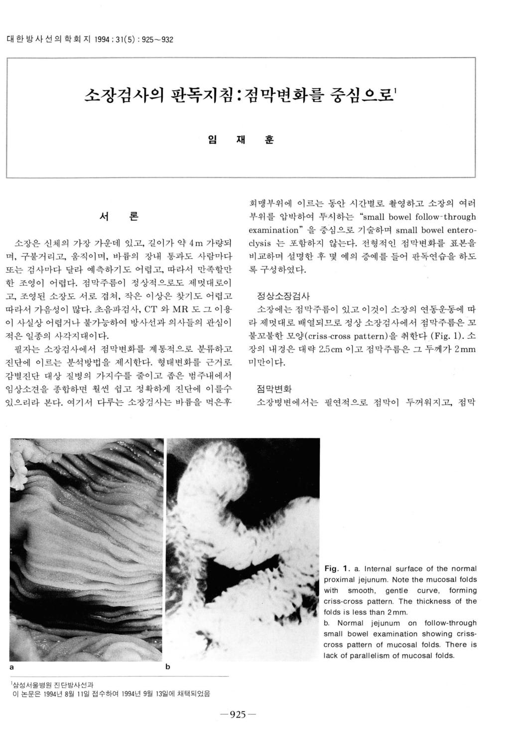 ι대한방사선의학회지 1994 ; 31(5) : 925-932 소장검사의판독지침 : 점막변화를중심으로 1 임재훈 회맹부위에이르는동안시간별로촬영하고소장의여러 서론소장은신체의가장가운데있고, 길이가약 4m 가량되며, 구불거리고, 움직이며, 바륨의장내통과도사람마다또는검사마다달라예측하기도어렵고, 따라서만족할만한조영이어렵다.