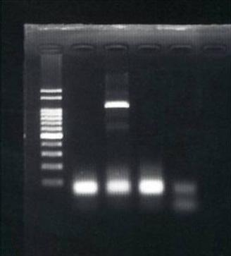 Hepatitis B virus (HBV)-DNA polymerase chain reaction (PCR) (agarose gel electrophoresis) and direct sequencing of the s region.