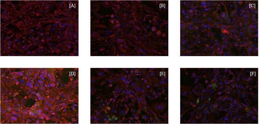 Fig. 3-3. Immunofluorescence study of the activated insulin receptor substrate 1 (IRS-1).