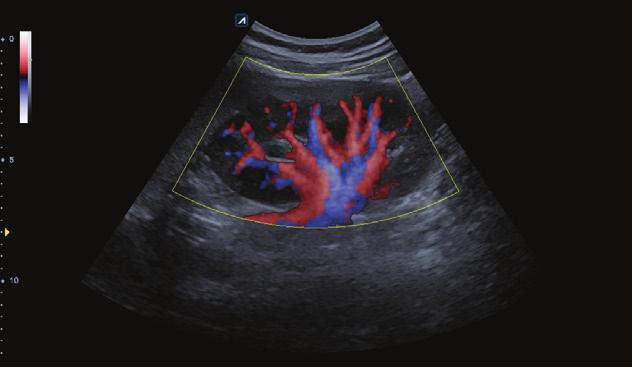 조영제가 혈관, 장기 조직에 확산되며 나타나는 여러 가지 조영 Auto IMT는 경동맥 내막-중막 두께 자동 측정