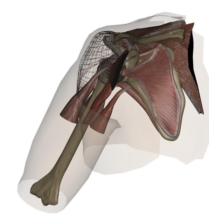 Arthroscopic surgery simulator 3D