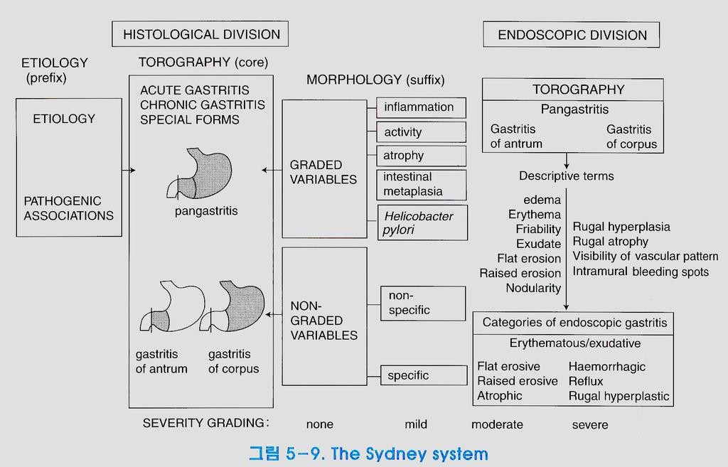 위염 Fig. 1. The Sydney System; histologic division and endoscopic division. 6 는데 2 병리학적기재사항이별로없다는단점을제외하면만성위염분류법의원형을확립했다는평가를받고있으며이미미지의세균감염이만성위염발생에관여한다고언급을하고있다.