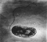 - 비브리오블리피쿠스 (Vibrio vulnificus) 비브리오블리피쿠스 (Vibrio vulnificus) 호염성세균으로최적식염농도는 1~3%, 0% 및 8% 이상에서는생육이급격히억제되고증류수에서는급격히불활성화됨 호염성세균 비브리오패혈증에의한감염으로잠복기는 1~2일 피부감염의경우는 12시간
