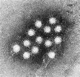 - A 형간염바이러스 (Hepatitis A virus) A 형간염바이러스 (Hepatitis A virus) 간염바이러스의한종류인 A 형간염바이러스 (hepatitis A virus) 15~50 일 ( 평균약 28 일 )