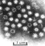 - 사포바이러스 (Sapovirus) 사포바이러스 (Sapovirus) 5가지 group(i, II, III IV, V) 으로분리되며,