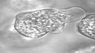 - 이질아메바 (Entamoeba histolytica) 이질아메바 (Entamoeba histolytica) 이질아메바증은사람을포함하여다른영장류와일부동물의대장내에기생하는가장흔한기생충 생활환은포낭 (cyst) 과영양형