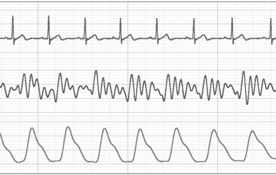뇌전도 (EEG) EER=18.3% 심전도 (ECG) 심탄도 (BCG) 광용적맥파 (PPG) EER=15.
