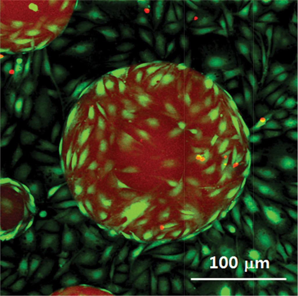 682 김진구 참고문헌 Figure 7. Microscopic image of W-20-17 cells cultured on PEGSDA microgels. 것으로사료된다.