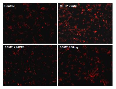 우 찬 유주연 장철용 김효린 신용진 문아지 신선호 4. 小續命湯이 MPTP 에의한 ROS 생성에미치는영향파킨슨병을유도한모델에이용되는 MPTP 는세포내 oxidative stress 를유발하는것으로알려져있다.