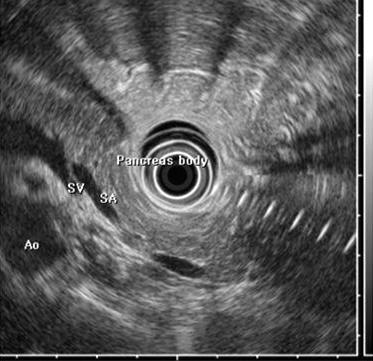 Figure 7. Radial EUS serial images from pancreas head to tail. 되는데검사자가서서히몸을회전시키는것이좋다.