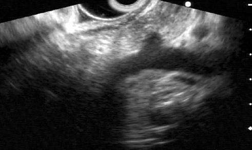 Figure 9. Linear EUS images in stomach. 심방과폐동맥사이공간이용골하부위이다.