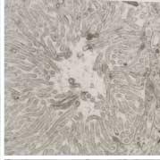 Intracellular lumen contains microvilli and cilia having peripheral nine doublet and central doublet (, ).