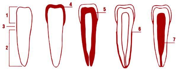 이 : 구조 1. 치관 : 잇몸에서돌출한보이는부분의이 2. 뿌리 : 잇몸에묻혀있는부분의이 3. 목 : 치관과잇뿌리사이의부분 4.