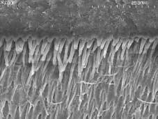a b Figure 1. SEM micrograph of the bonded interfaces treated with 6 N HCl and 3.5% NaOCl of MP group.