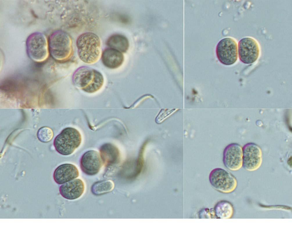 12 (Algae) II A B C D 25 μm 1. A D. Chroococcus limneticus. 2. Chroococcus minimus (Keissler) Lemmermann 1904 ( 2A D) Komárek and Anagnostidis 1999: 286. f. 371. Hu and Wei 2006: 88. pl. II-16-9.