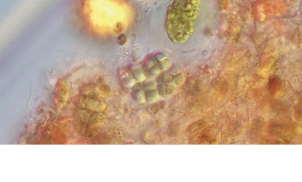 22 (Algae) II, Chroococcus turgidus (Kützing) Nägeli. 9. Chroococcus turgidus (Kützing) Nägeli 1849: 46 ( 9A). Yamaghshi and Akiyama 1985a: 3: 11. Chung 1993: 198. f. 31-a. f. 31-b.