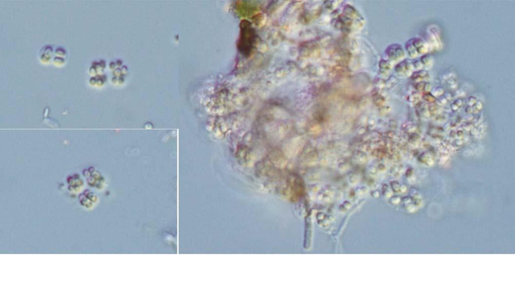 24 (Algae) II A C B 25 μm 10. A C. Chroococcus vacuolatus. :. : (36 43 08 N, 129 24 26 E), 16.viii.2011. :,. : Limnococcus. Family Merismopediaceae Elenkin 1933: 19..,. (mucilage),,.