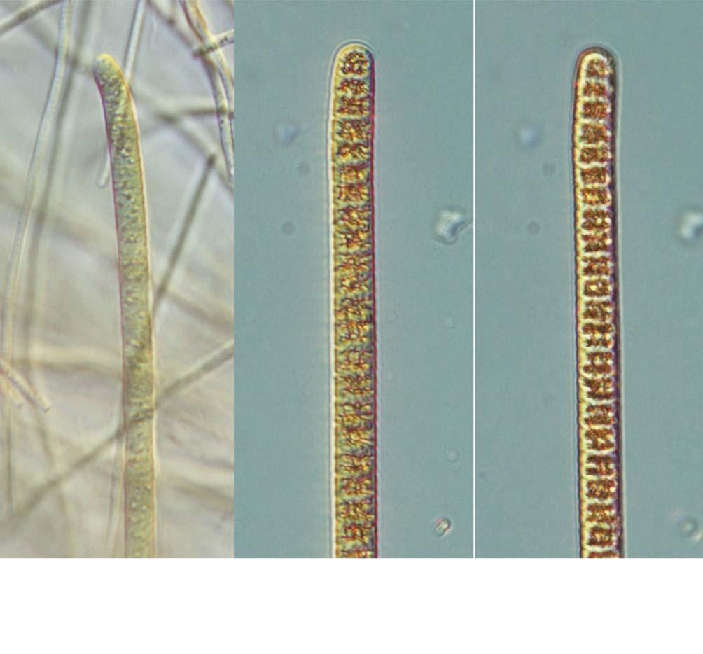 54 (Algae) II A B C 25 μm 25. A. Planktothrix agardhii; B, C. Plalnktothirx compressa. :.