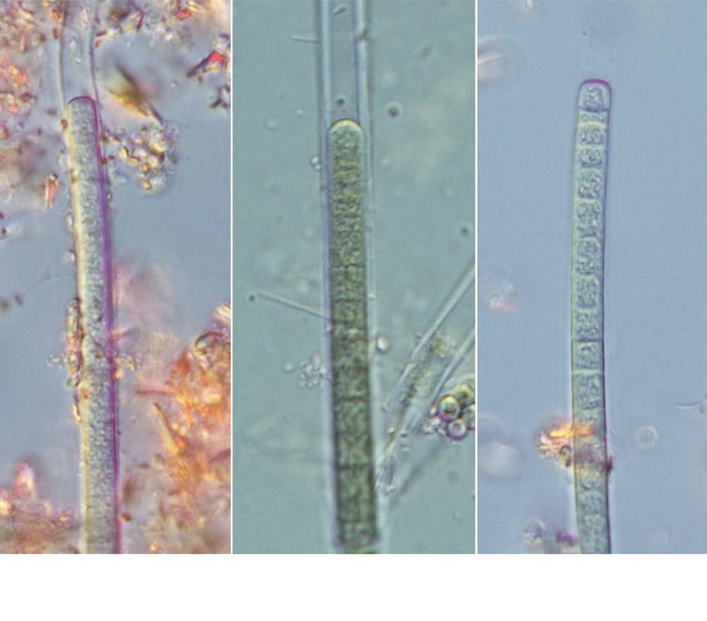 60 (Algae) II A B C 25 μm 27. A, B. Phormidium aerugineo-caeruleum; C.