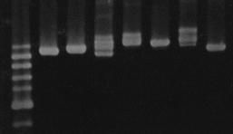 M 1 2 3 4 5 6 7 M 1 2 3 4 5 6 7 8 1000 bp 900 bp 800 bp 500 bp 300 bp 200 bp 175 bp 150 bp 100 bp Fig. 4. 16S-23S ILP patterns of 7 type strains of Acinetobacter species in a 1.