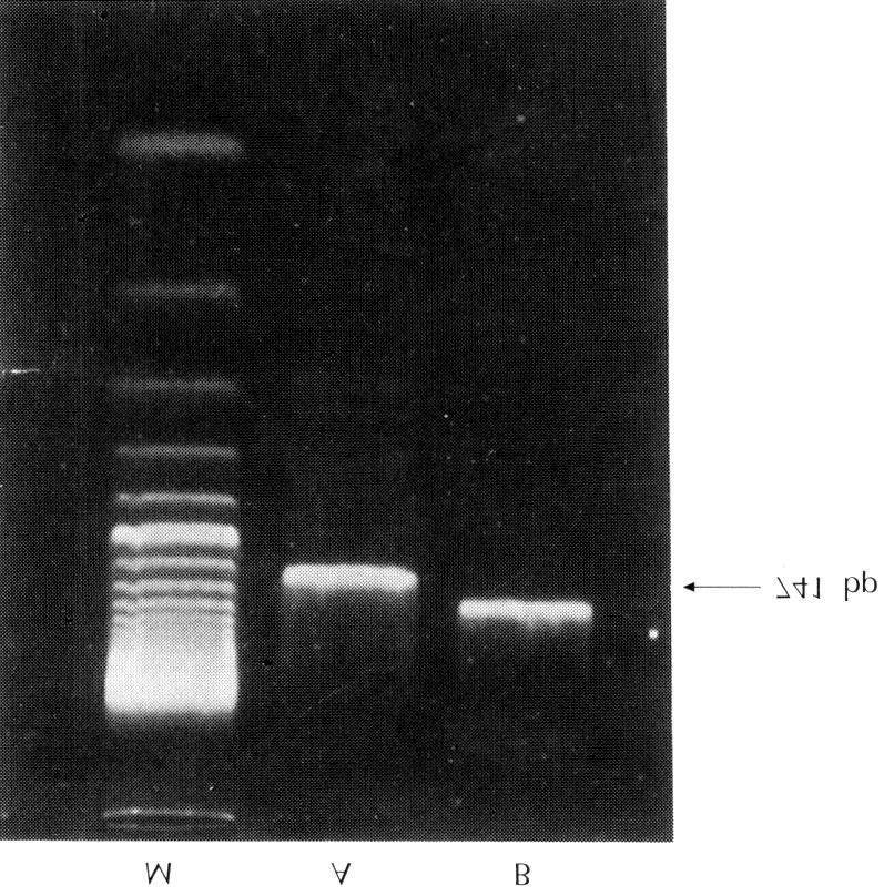Fig. 1. Representative ethidium bromide-stained agarose gels of unlabeled RT-PCR products A and DIG digoxigenin labeled product B for inos in LPS treated macrophage cell.