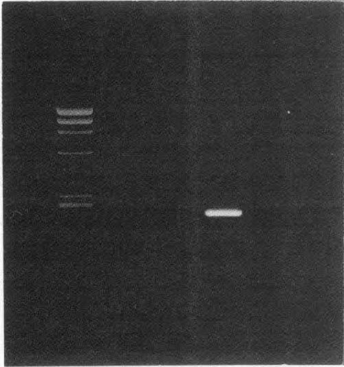 tuberculosis infected M : Molecular standard marker(phix174/hae m) cells(324 bp) Lane 2 : First PCR negative control Lane 3 : Nested - PCR of M.