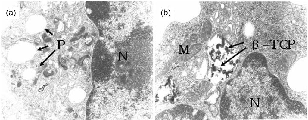 김영희 Anirban Jyoti 변인선 오익현 민영기 양훈모 이병택 송호연 622 Fig. 4. Fig. 5. Transmission electron microscopic images of osteoclast-like Raw 264.
